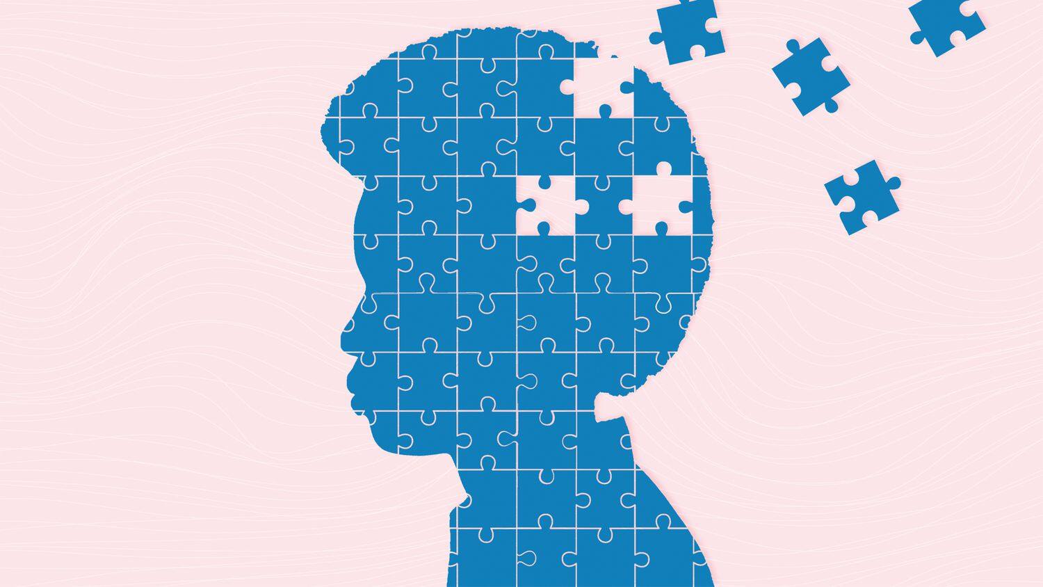 Pseudo Dementia In Modern Age: Unlocking Cognitive Wellness With '3 A Strategy' - Vimarsana News