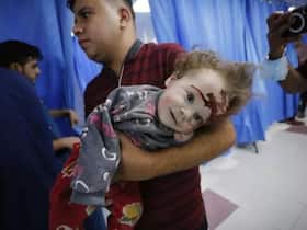 Israel   Hamas War 2023: Haunting Images of Hospital Victims Shock the World - IN PICS