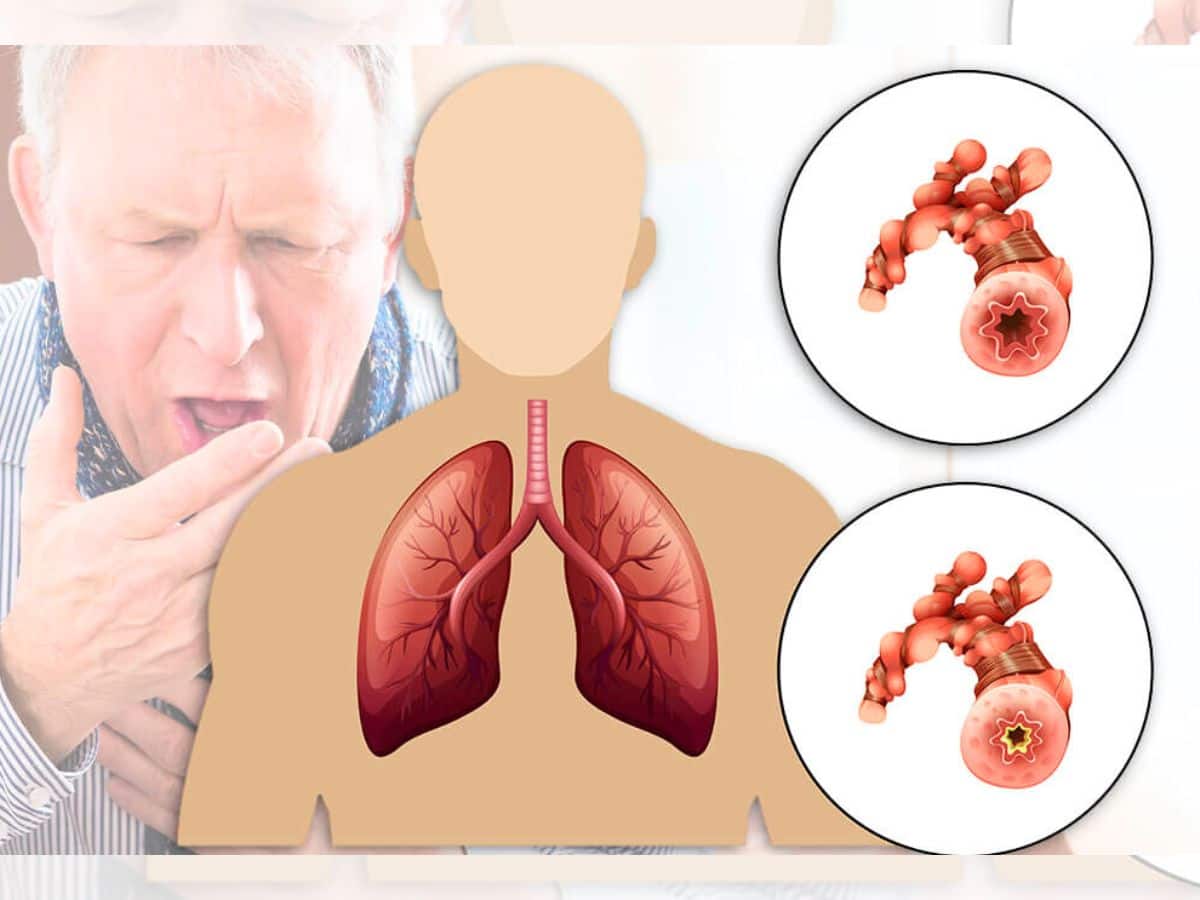 COPD Treatment Methods: Unlocking the Potential of EMRs for Effective COPD Management
