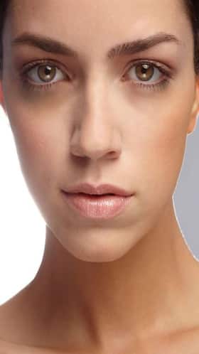 Causes and Treatment of Under-Eye Dark Circles
