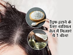 नारियल तेल में इस एक चीज को मिलाकर लगाएं, सालों पुरानी रूसी होगी छूमंतर