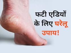 सर्दी के मौसम में फटी एड़ियों से छुटकारा दिलाएंगे ये 5 शानदार घरेलू उपाय