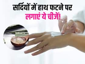 सर्दियों में रूखे और फटे हाथों पर लगाएं ये 5 चीजें, बन जाएंगे मक्खन से मुलायम