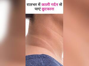 रातों-रात काली गर्दन से छुटकारा दिलाए ये 7 नुस्खे