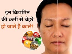 शरीर में इन 5 विटामिन की कमी से चेहरा दिखता है काला, पूर्ति करने के लिए इन चीजों का करें सेवन