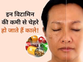 शरीर में इन 2 विटामिन की कमी से स्किन होने लगती है काली, पूरा चेहरा होने लगता है खराब