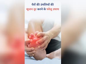 सर्दियों में पैरों की उंगलियों की सूजन दूर करने के घरेलू उपाय