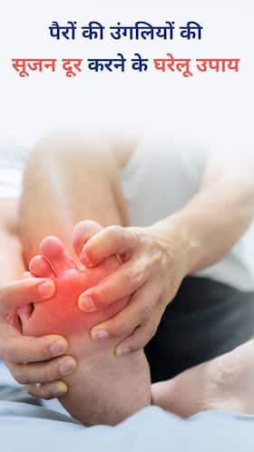 सर्दियों में पैरों की उंगलियों की सूजन दूर करने के घरेलू उपाय