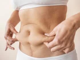 Brazilian Influencer Dies After Liposuction Surgery: What Could Have Gone Wrong?