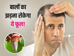 छत के गमले में लगा ये फूल तुरंत रोकेगा पुरुषों का हेयरफॉल, कई लोगों को हुआ है फायदा