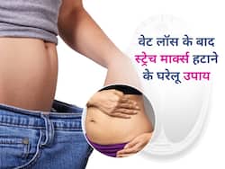 वेट लॉस के बाद शरीर पर दिखने लगे हैं स्ट्रेच मार्क्स? इन 5 घरेलू नुस्खों से पाएं छुटकारा