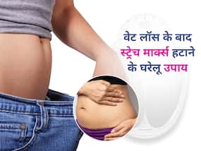वेट लॉस के बाद शरीर पर दिखने लगे हैं स्ट्रेच मार्क्स? इन 5 घरेलू नुस्खों से पाएं छुटकारा