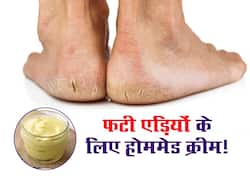 सोने से पहले फटी एड़ियों से लगाएं ये होममेड क्रीम, रातभर में पैर हो जाएंगे सॉफ्ट