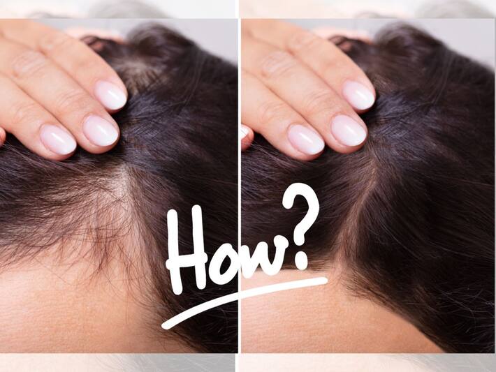 How To Grow New Hair 7 Tips To Grow Hair Naturally In Just 15 Days