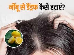 सर्दियों में डैंड्रफ से भर गया है आपका स्कैल्प?  इन 3 तरीकों से करें नींबू का इस्तेमाल, जल्द मिलेगा छुटकारा