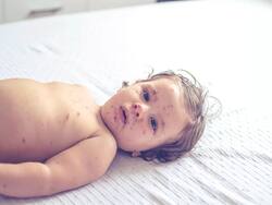 WHO Report: दुनिया में तेजी से बढ़ रहा खसरा से होने वाली मौत का खतरा, भारत में भी लाखों बच्चों पर मंडरा रहा खतरा