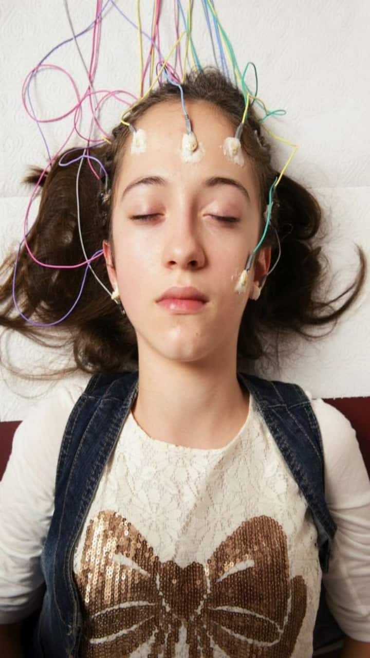 National Epilepsy Day 2023 Causes To Know