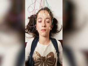 National Epilepsy Day 2023: Causes To Know