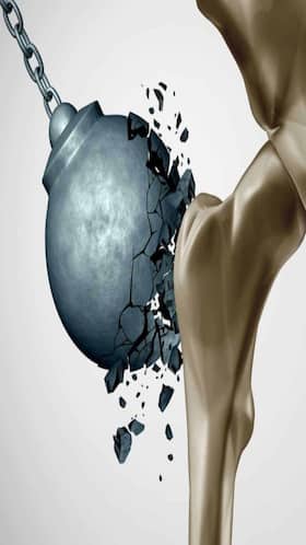 What Habits Should You Avoid for Better Bone Health? What Habits Should You Avoid for Better Bone Health?