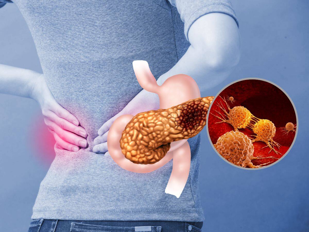 t Ignore These 5 Signs Of Pancreas Damage In Your Urine At Night