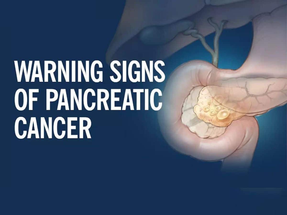 Pancreatic Cancer Symptoms: 6 Unusual Signs of Pancreatic Cancer You Should Never Ignore