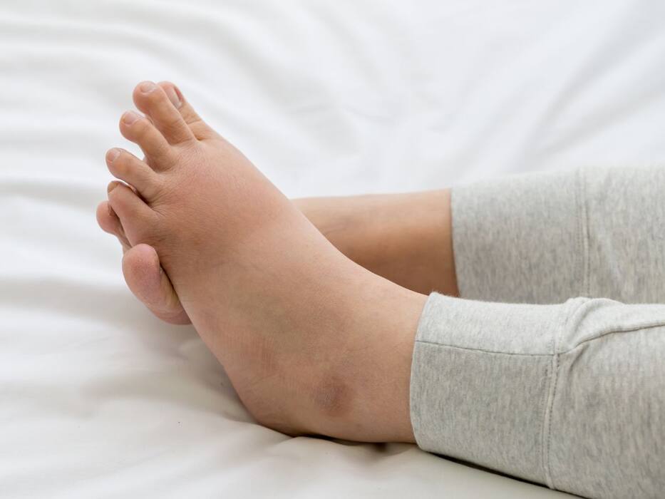 Winter Heart Attack Symptoms: 5 Signs That Only Appears at Night
