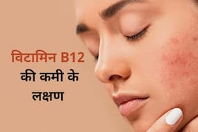 चेहरे पर दिख रहे ये 5 लक्षण हैं विटामिन B12 की कमी का संकेत, जानें Vitamin B12 के बेस्ट सोर्स