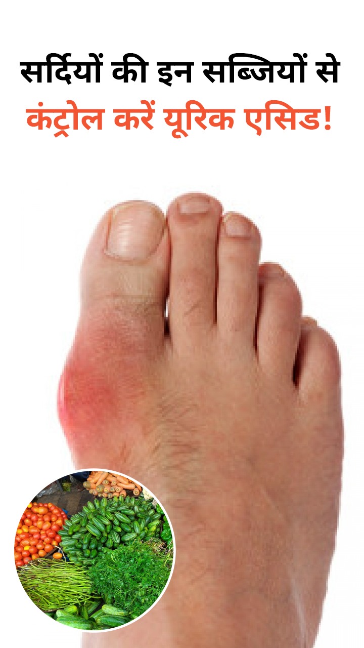 यूरिक एसिड को कंट्रोल करेंगी सर्दियों की ये 7 सब्जियां
