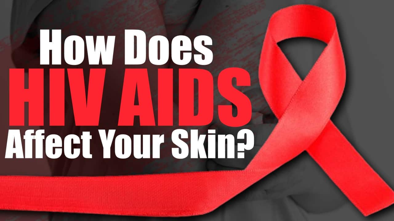 World AIDS Day 2023: How AIDS affects your skin | Measures to prevent ...