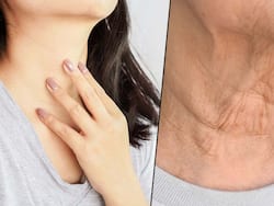 रातों-रात झुर्रियों को गायब करने के लिए नारियल तेल में मिलाएं ये 2 चीजें, रोजाना इस तरह करें इस्तेमाल