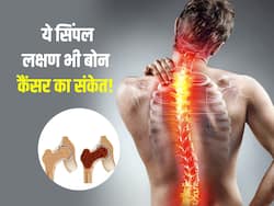 इस तरह का पीठ दर्द हो सकता है, हड्डी कैंसर का संकेत, ये 4 लक्षण करते हैं Bone Cancer की ओर इशारा