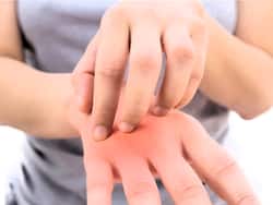 क्या सर्दियां शुरू होते ही आपके हाथ-पैरों में भी खुजली होने लगी है? ये घरेलू इलाज 2 दिन में देगा आराम