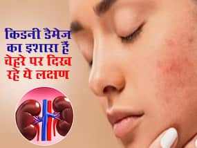 चेहरे पर दिखने वाले ये 4 संकेत बताते हैं पूरी तरह डैमेज हो गई है आपकी किडनी चेहरे पर दिखने वाले ये 4 संकेत बताते हैं पूरी तरह डैमेज हो गई है आपकी किडनी