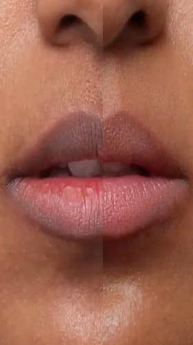 Steer Clear of These 8 Habits That Can Harm Your Lips