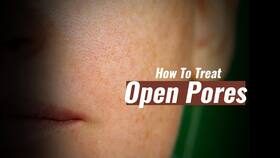 Skin Care Tips: 2 Amazing Home Remedies for Open Pores You Must Try