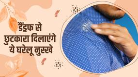 Home Remedies for Dandruff: बालोें में डैंड्रफ से हैं परेशान, तो ये 3 घरेलू नुस्खे करेंगे आपकी मदद