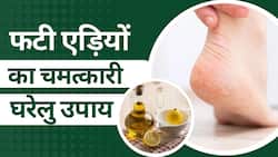 Cracked Heels Remedies: फटी एड़ियों को एक हफ्ते में मुलायम बनाएंगी घर की ये चीजें