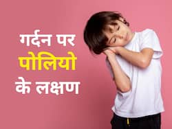 पोलियो होने से पहले गर्दन पर दिखता है ये लक्षण, जानें पोलियो के कारण और सबसे जरूरी संकेत