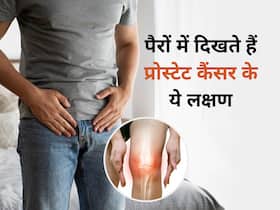 पैरों में दिख रहे ये लक्षण प्रोस्टेट कैंसर का हो सकते हैं संकेत, आम समझकर न करें इग्नोर