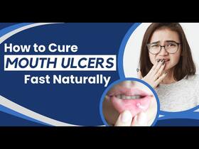 Mouth Ulcers: How to Get Rid of Mouth Ulcers Overnight?