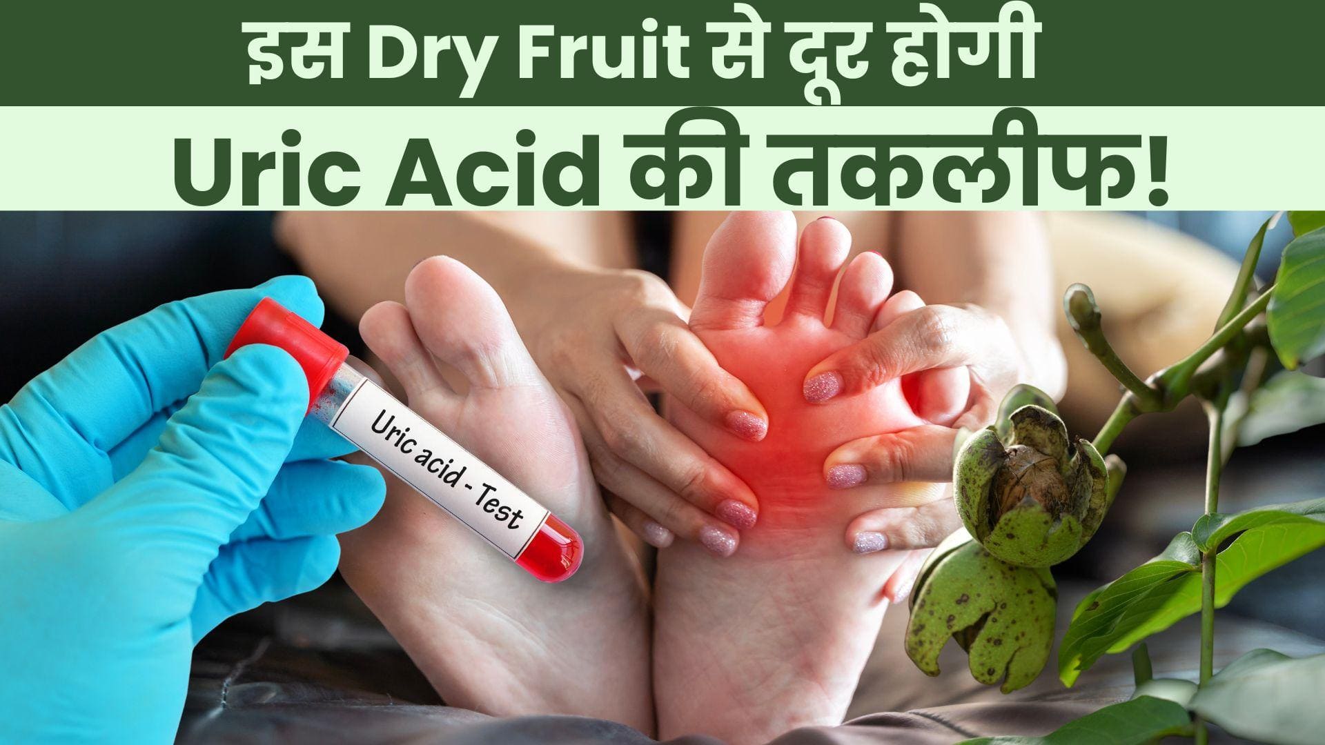 Uric Acid Treatment इस Dry Fruit को खाने से कंट्रोल होगा Uric Acid
