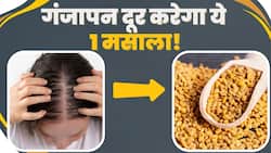 Fenugreek Seeds For Hair Fall: गंजेपन से छुटकारा दिला सकता है किचन में रखा ये पीला मसाला