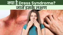 Painkiller Side Effect: क्‍या होता है Dress Syndrome, जानिए इसके लक्षण और इलाज