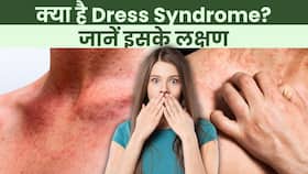 Painkiller Side Effect: क्‍या होता है Dress Syndrome, जानिए इसके लक्षण और इलाज