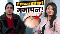 How to Control Hair Fall? गंजेपन को दूर करने के लिए अपनाएं ये आसान तरीका