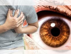 5 Unusual Heart Attack Symptoms That Can Appear In Your Eyes