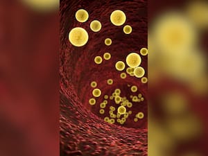 8 Lifestyle Changes To Lower High Cholesterol Levels by 10% in 30 Days