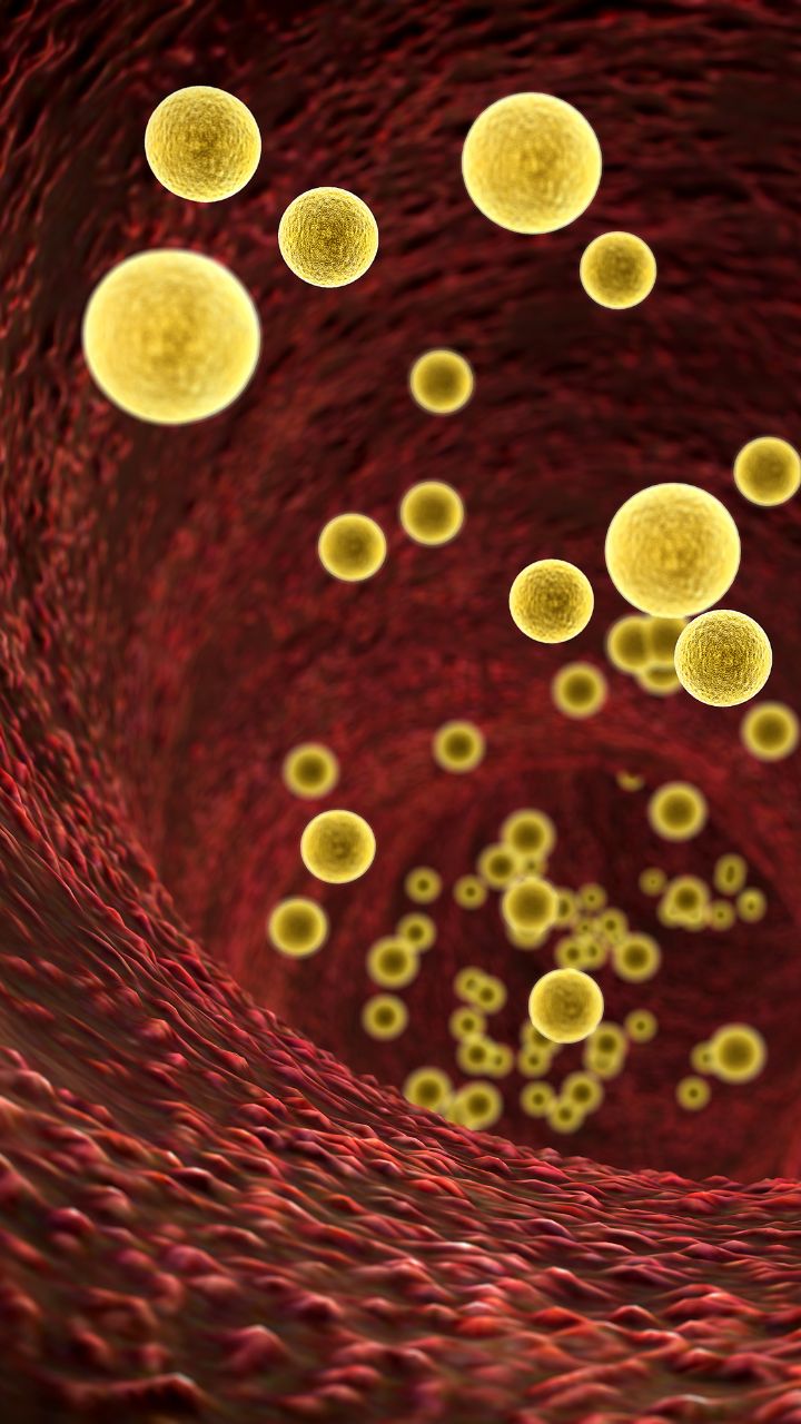 8 Lifestyle Changes To Lower High Cholesterol Levels by 10% in 30 Days