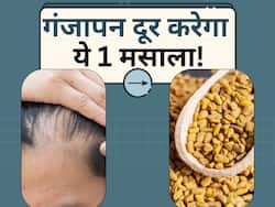 गंजेपन से छुटकारा दिला सकता है किचन में रखा ये पीला मसाला, कुछ ही दिनों में उग आएंगे बाल