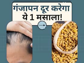 गंजेपन से छुटकारा दिला सकता है किचन में रखा ये पीला मसाला, कुछ ही दिनों में उग आएंगे बाल